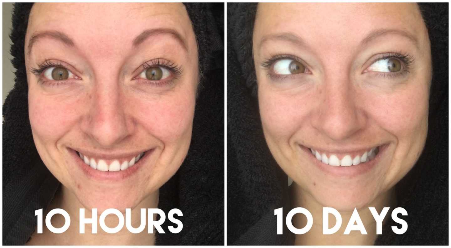 Been Using Miracle 10 for 3 Months – Here’s My Results!